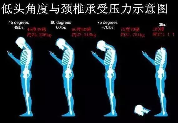 福州一男子下肢无力、行走不稳……教你4招远离颈椎病！