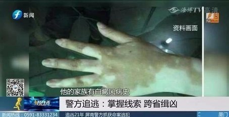 追凶21年！仅凭一张照片和一个体征　福建警方抓住逃犯