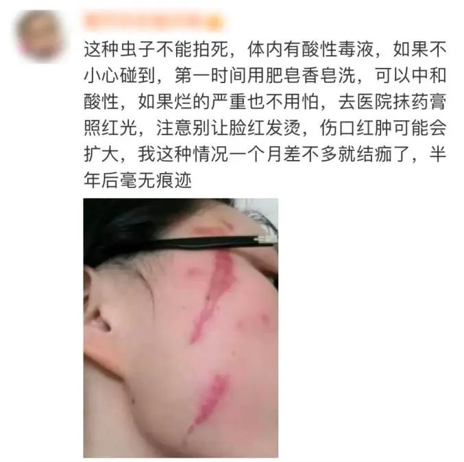 长乐人注意！千万别拍！有人差点毁容、失明……