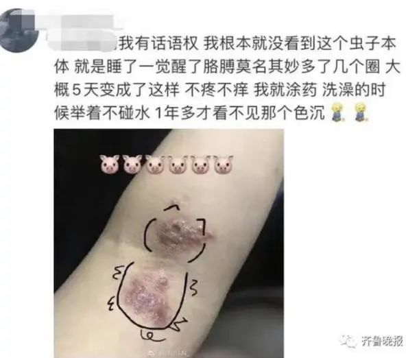 长乐人注意！千万别拍！有人差点毁容、失明……